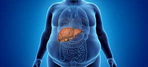 NAFLD Management Across Medical Disciplines