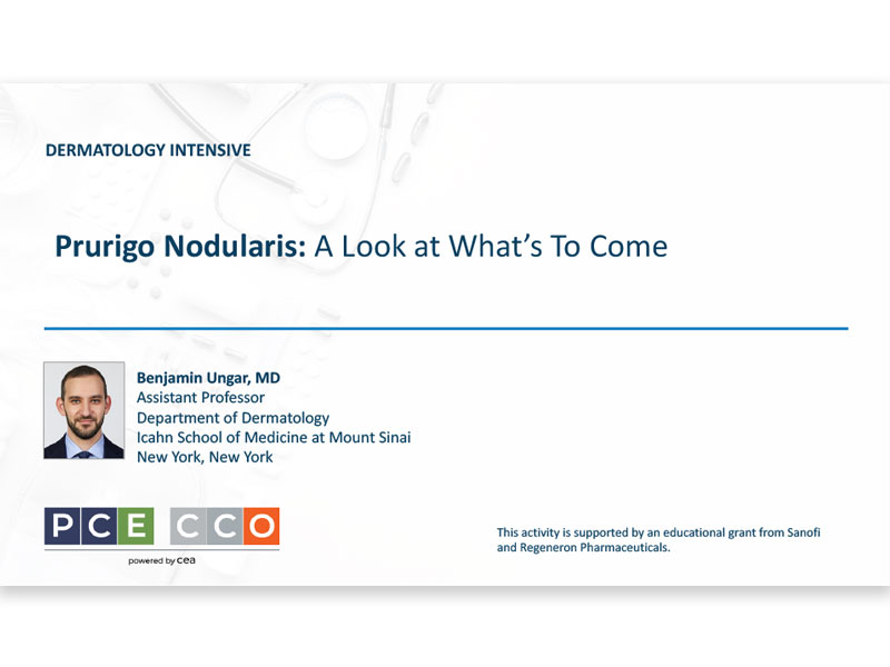 Prurigo Nodularis