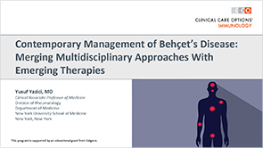 Slides on Behcet’s Management