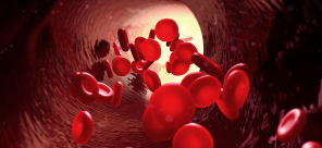 Hemophilia A FAQ
