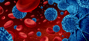 FAQs: Tx for MCL and DLBCL