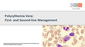Polycythemia Vera