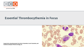 Essential Thrombocythemia