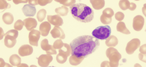 MPN FAQ