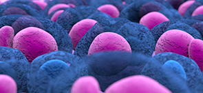 Treating Relapsed/Refractory Myeloma