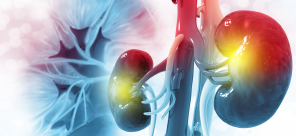 FAQ: Adjuvant Tx for RCC