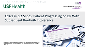 2L+: Ibrutinib Intolerance