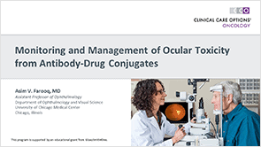 Managing ADC Eye Toxicity