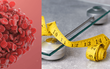 Managing VTE After Bariatric Surgery