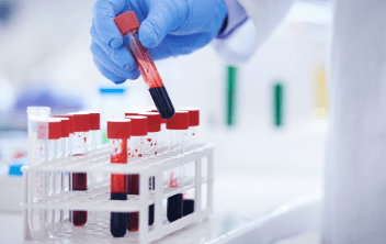 What is the Role of Multi-Cancer Early Detection (MCED) Tests in Clinical Practice?