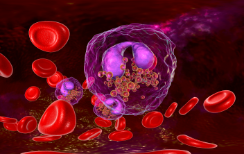 How I Manage My Patients With MCL, CLL, and SLL
