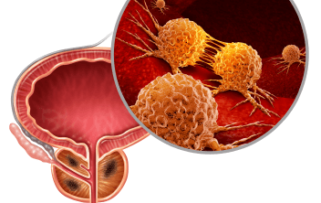 ASCO Genitourinary Cancers Symposium: A Focus on Prostate Cancer