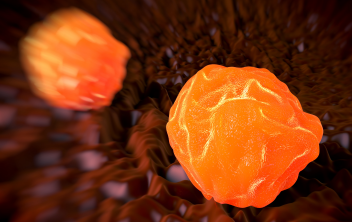 Targeted Therapy Comes to AML: Now What?