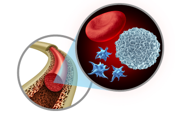 Fitting the Puzzle Pieces in Myelodysplastic Syndromes (MDS): A Look at Risk Stratification and Novel Agents