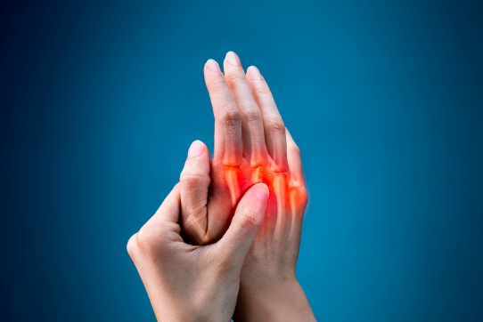 Rheumatoid Arthritis: Key Updates on Guidelines, JAK Inhibitor Safety, and COVID-19 Considerations