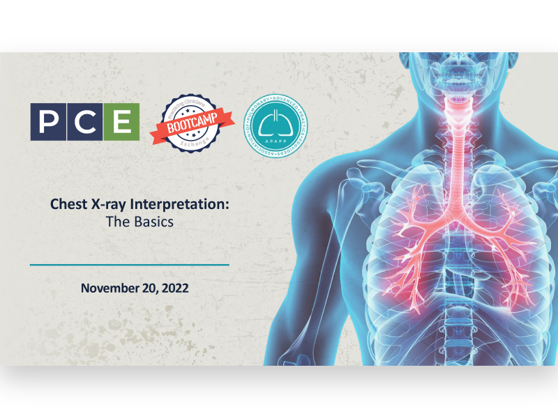Interpreting Chest X-Rays