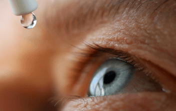 Dry Eye Disease: Steps to More Effective Management