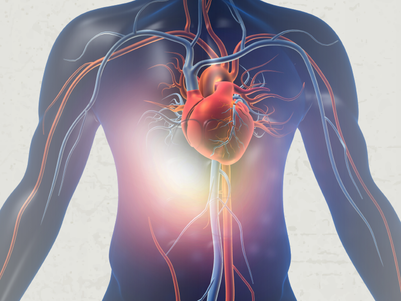 Resistant Hypertension