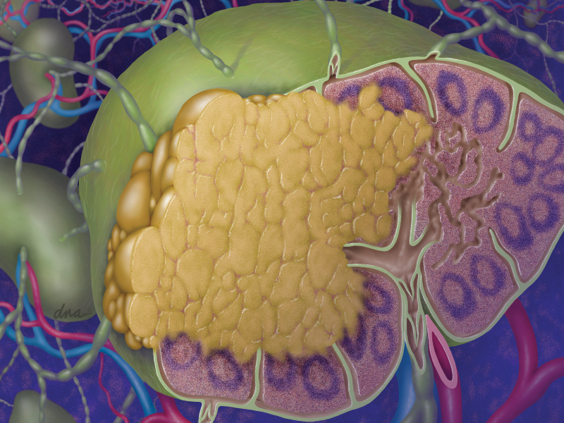 Relapsed/Refractory FL Update