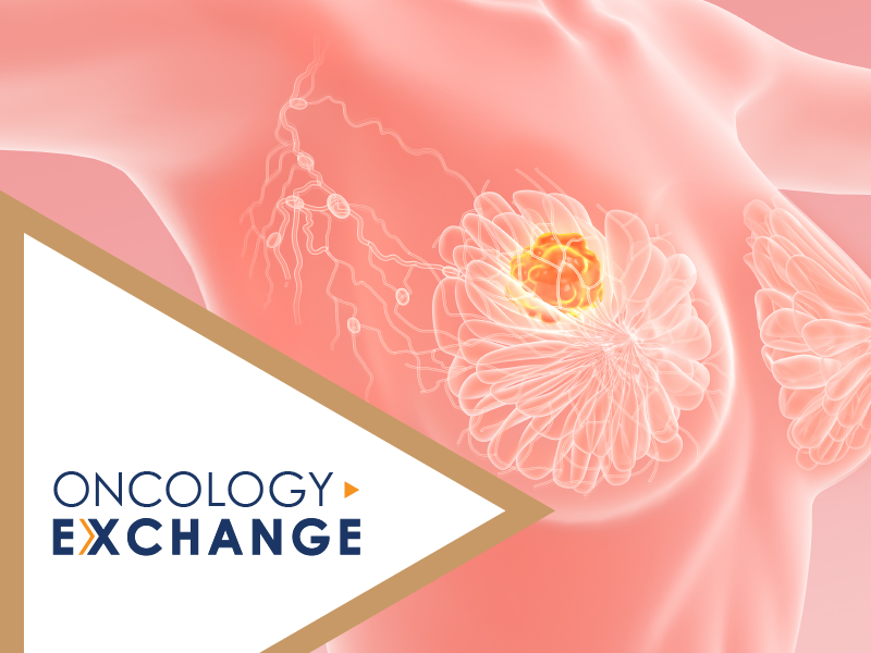 Evaluating the Evidence in HR-positive/HER2-negative Metastatic Breast Cancer