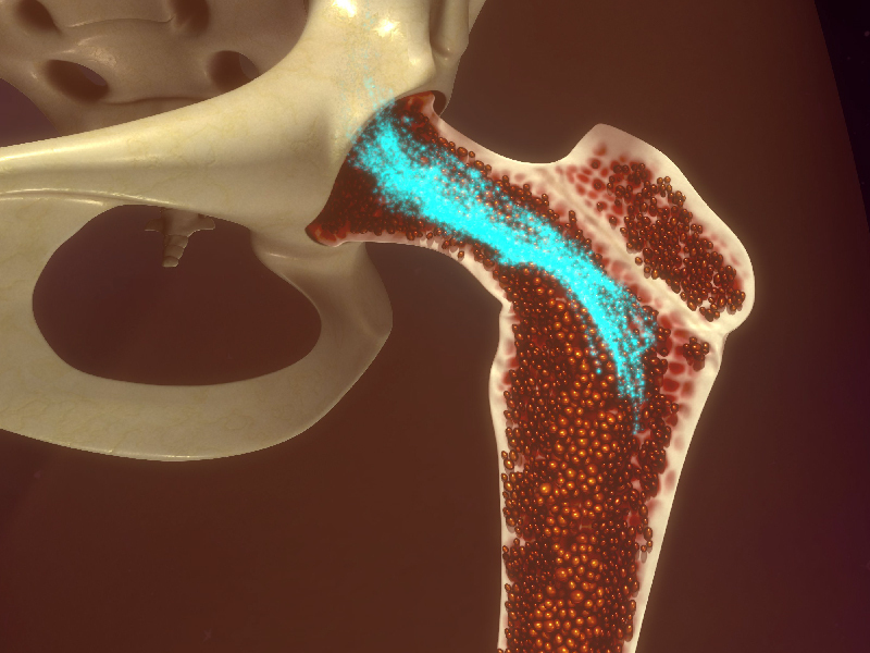 Challenges in MDS