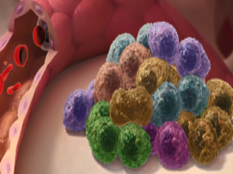 Myeloma Treatment