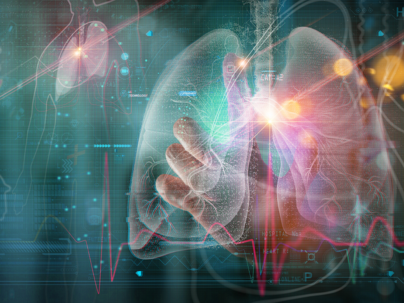 Radiographic Identification of Interstitial Lung Disease