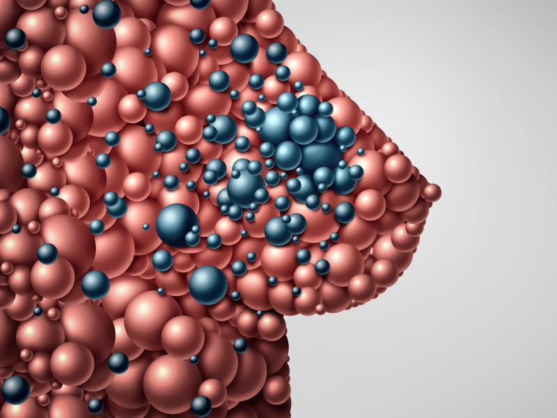 HER2- and TROP-2–Targeted Tx in Breast Cancer