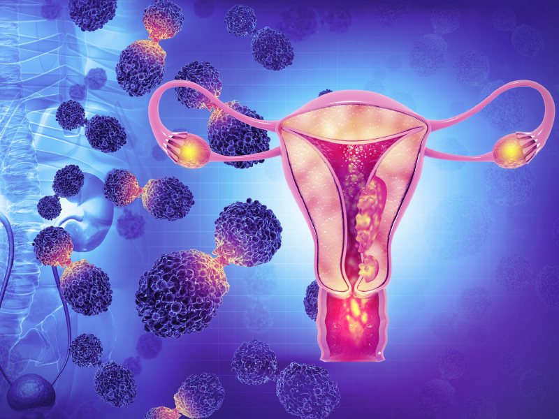 Precision Medicine in Gynecologic Cancers