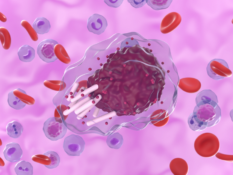 Treatment of CLL/SLL Webcast