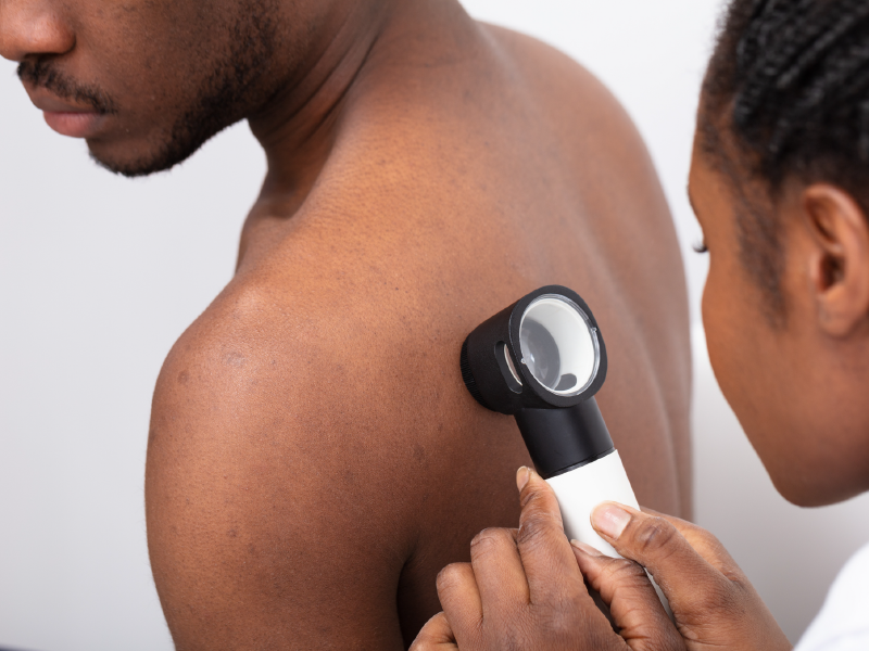Advanced Melanoma Therapy