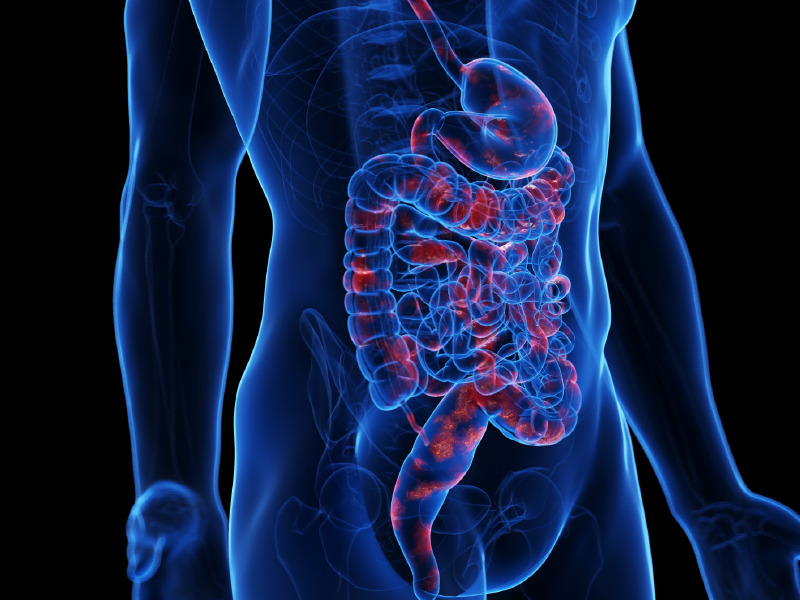 Advances in IBD