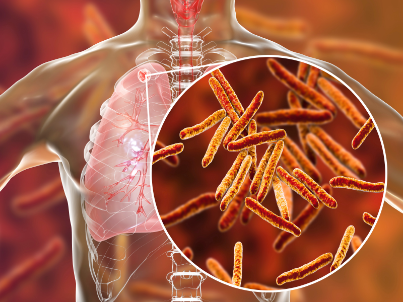Diagnosis and Treatment of a Growing Health Threat