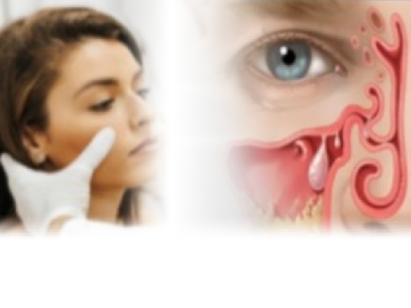 ProCE Banner Activity