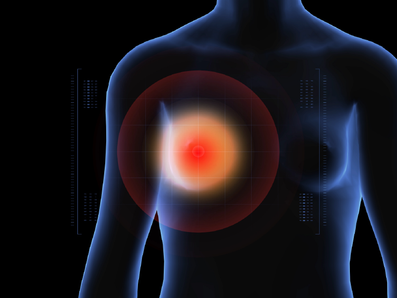 Targeted Therapy in EBC