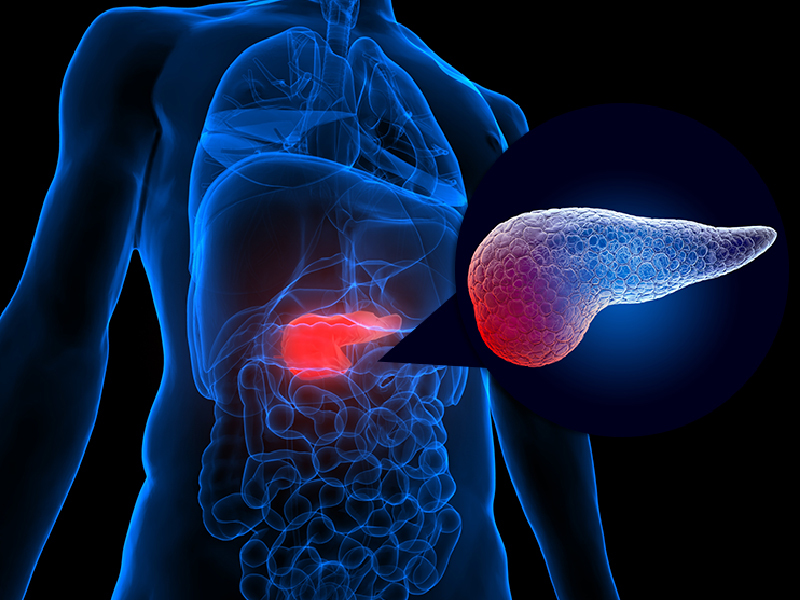 My Experience With GLP-1 Receptor Agonists in Patients With Type 2 Diabetes
