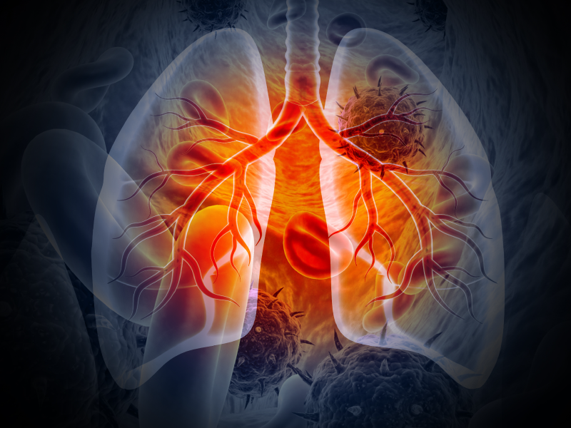 Collaborative Learning on TROP2 ADCs in NSCLC
