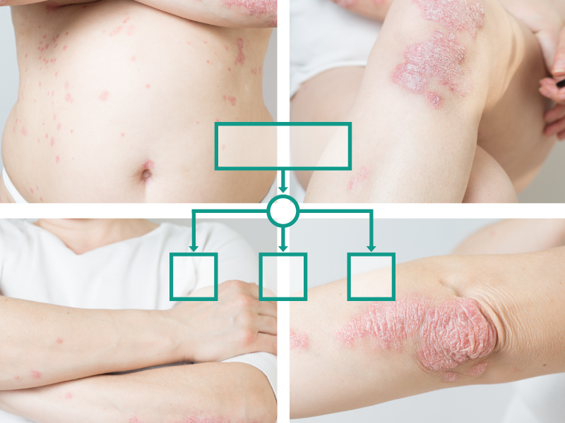 Psoriasis Treatment Strategies and Comorbidities