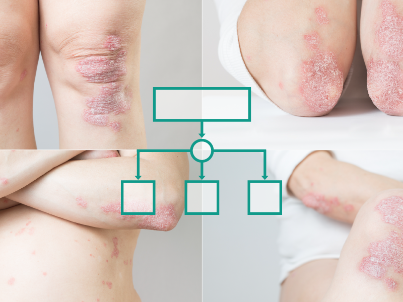 Treatment recommendations to improve outcomes in psoriasis care