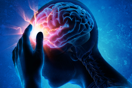 Essential Education for All Patients With Migraine